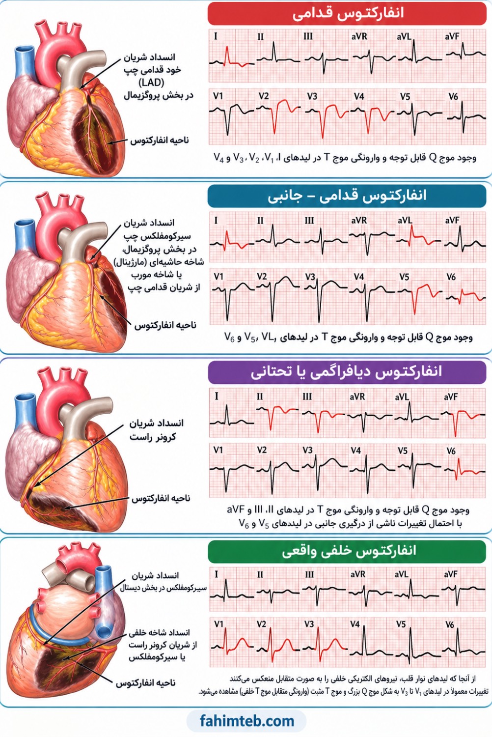عکس نوار قلب نامنظم