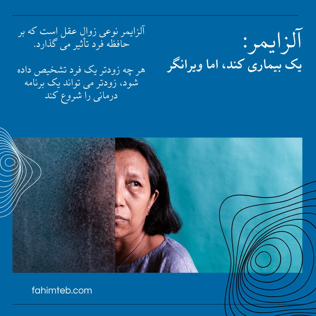 آلزایمر - زوال عقل