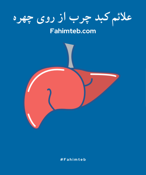 علائم کبد چرب از روی چهره - فهیم طب