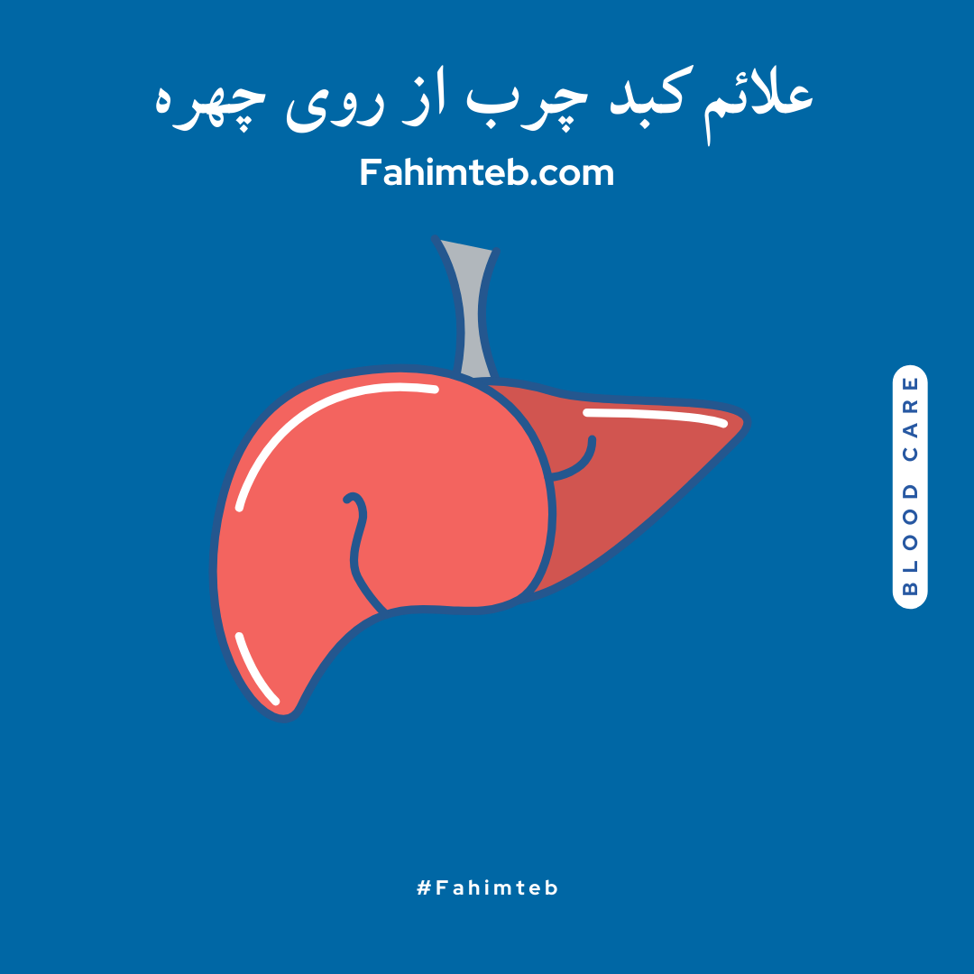 علائم کبد چرب از روی چهره - فهیم طب