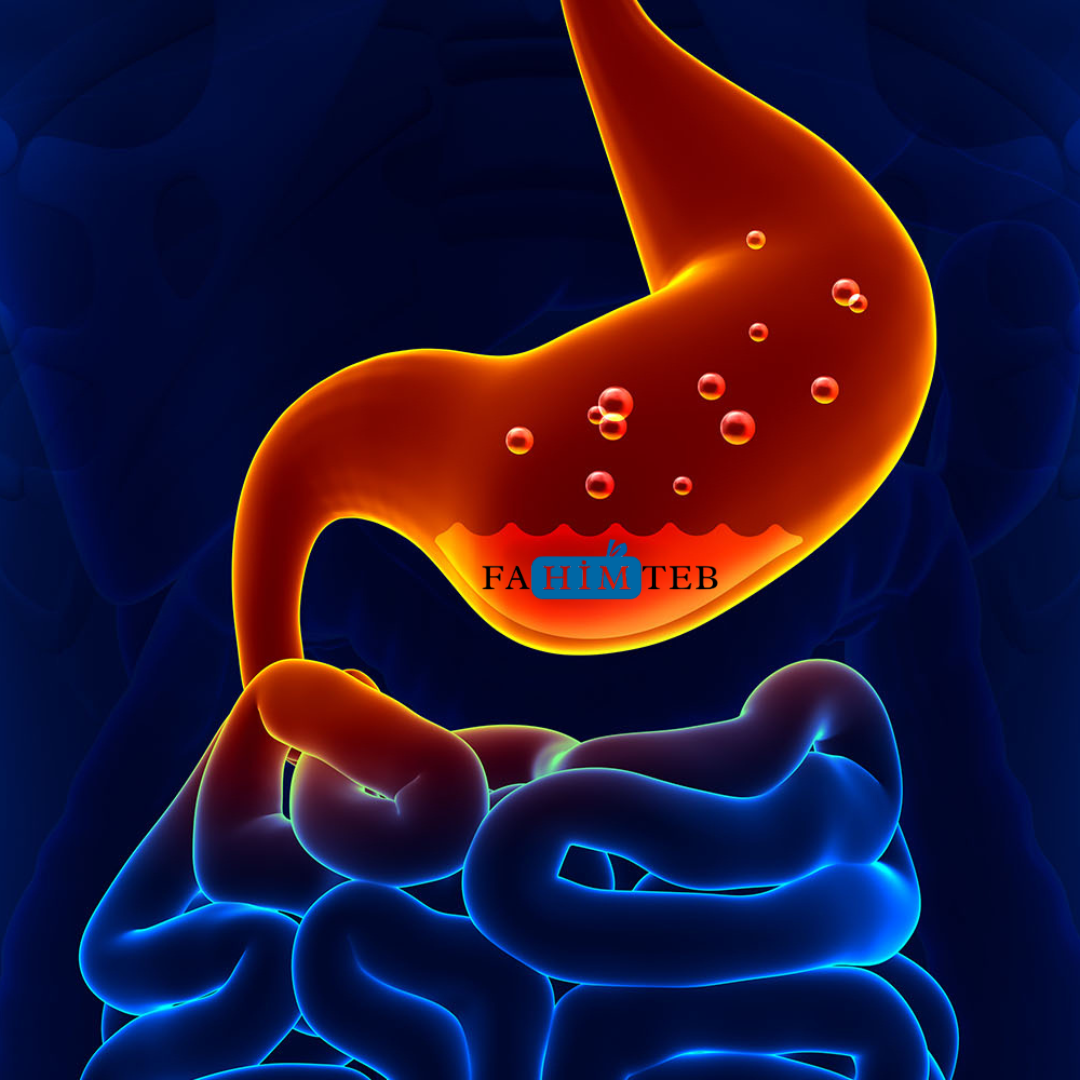 گاستریت - درد معده و ارتباط آن با کمر - فهیم طب امیر