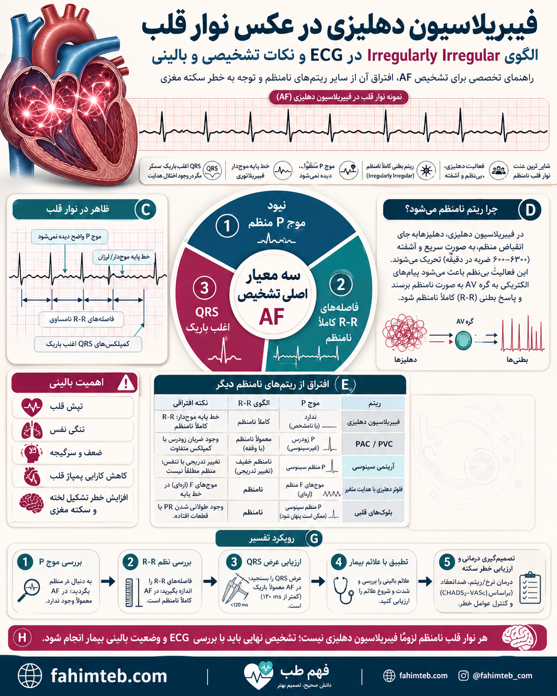 فیبریلاسیون دهلیزی در عکس نوار قلب؛ الگوی Irregularly Irregular | فهیم طــب