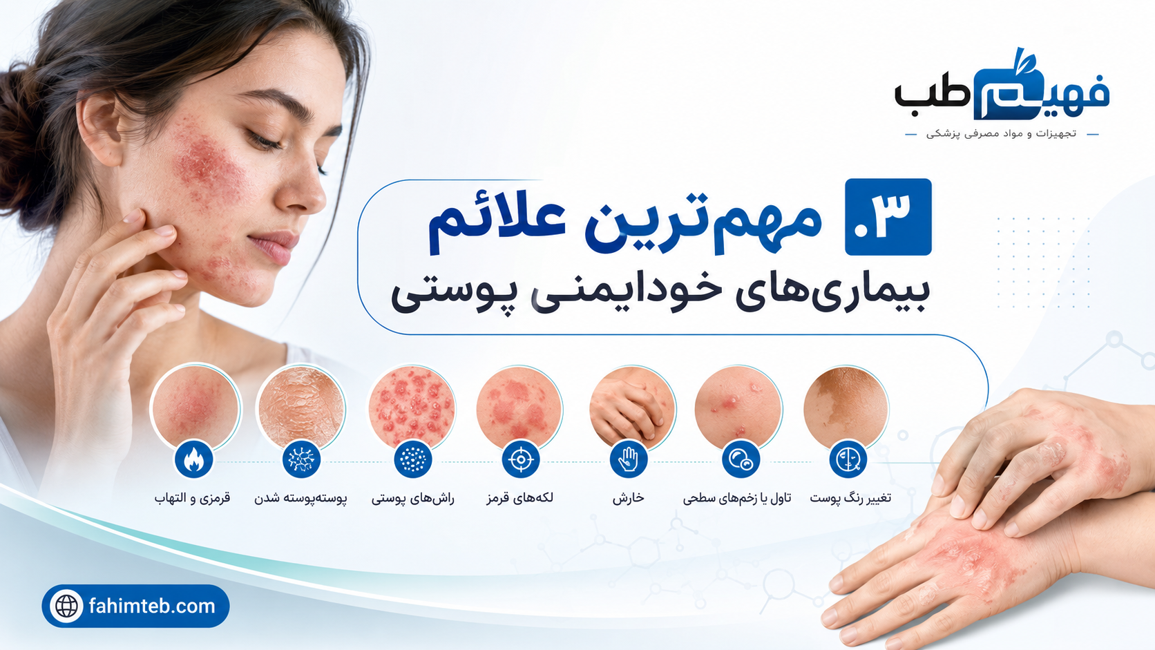مهم‌ترین علائم بیماری‌های خودایمنی پوستی