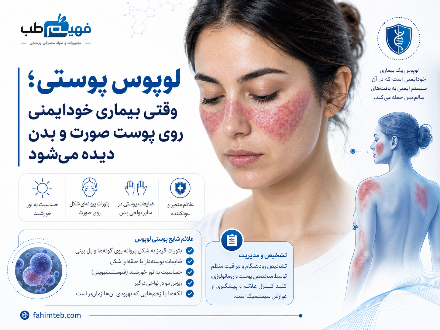 لوپوس پوستی