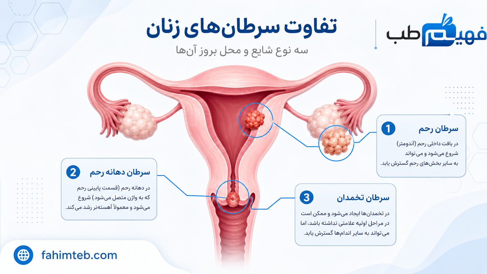 تفاوت سرطان رحم با سرطان دهانه رحم و سرطان تخمدان چیست؟