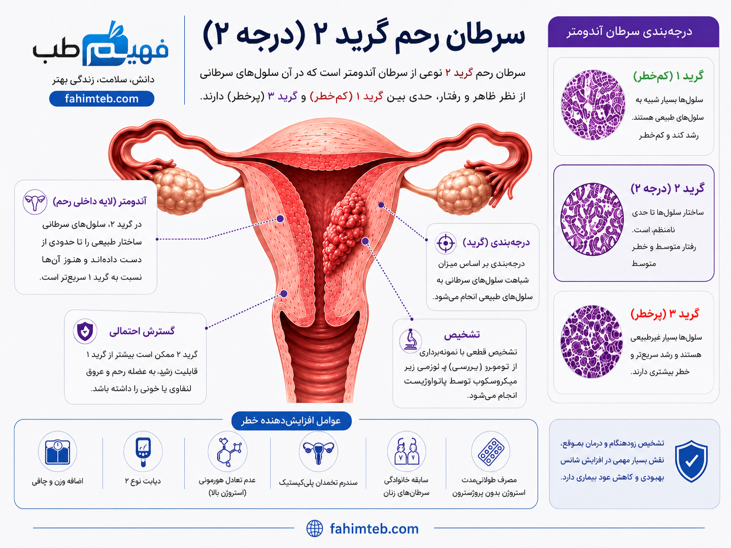 سرطان رحم گرید 2