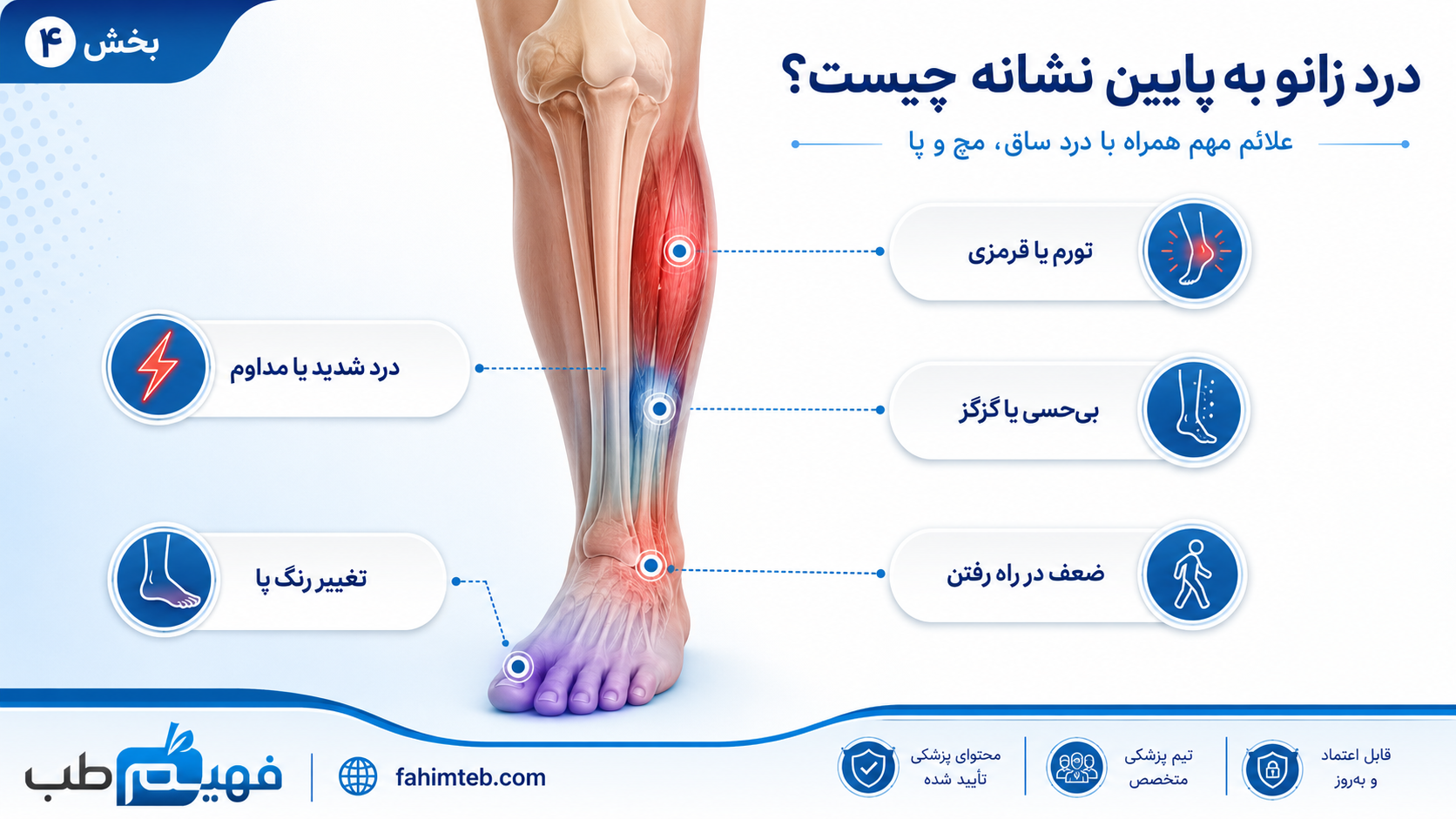درد زانو به پایین نشانه چیست؟
