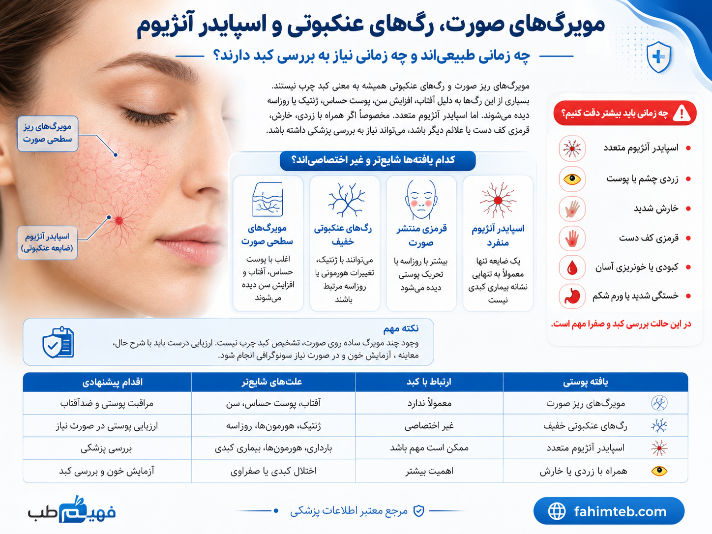 مویرگ‌های صورت، رگ‌های عنکبوتی و اسپایدر آنژیوم