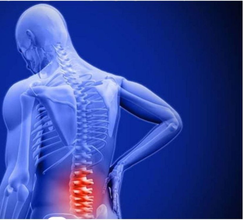 تا سال 2050 بیش از 800 میلیون نفر با کمردرد زندگی خواهند کرد