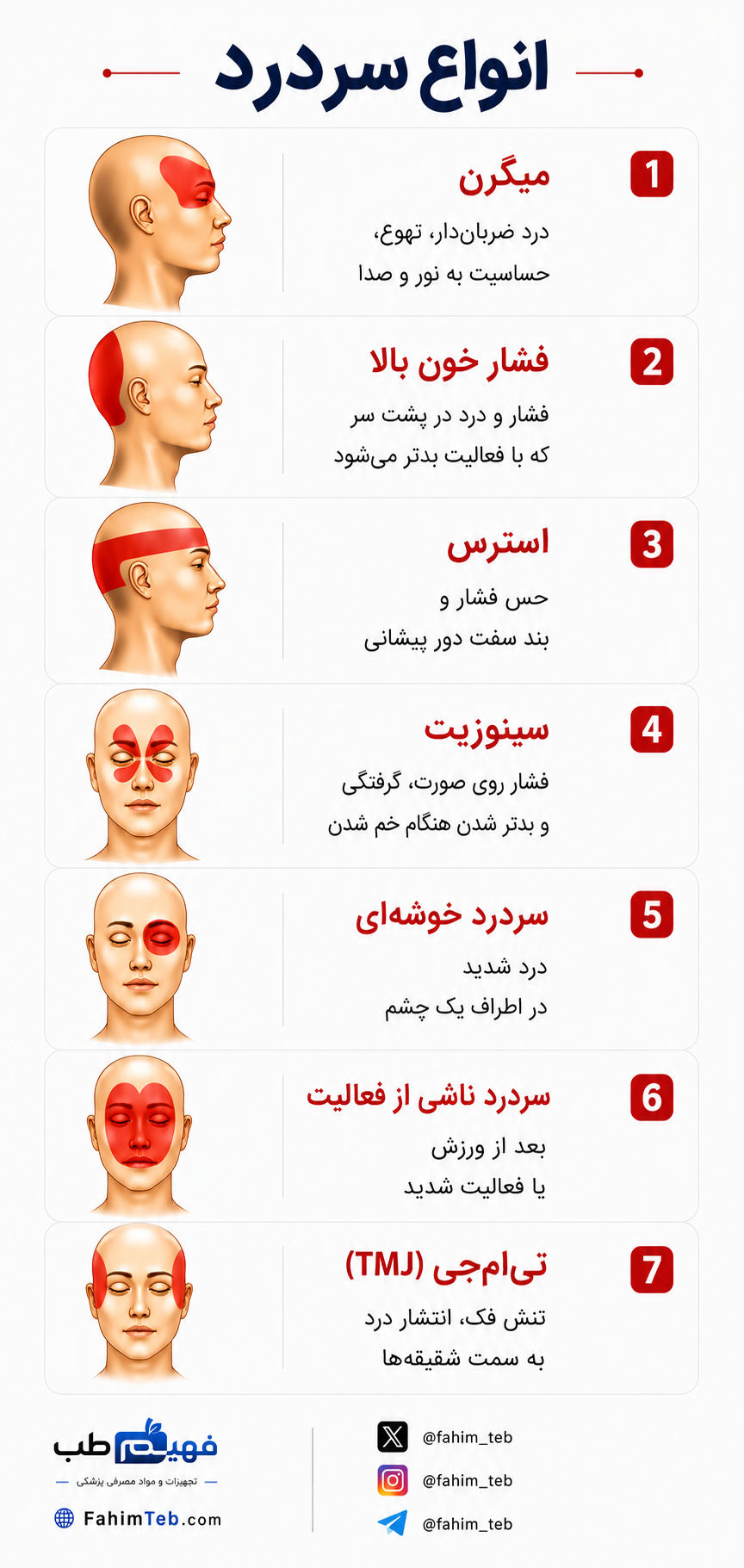 اتواع سردرد و محل آنها