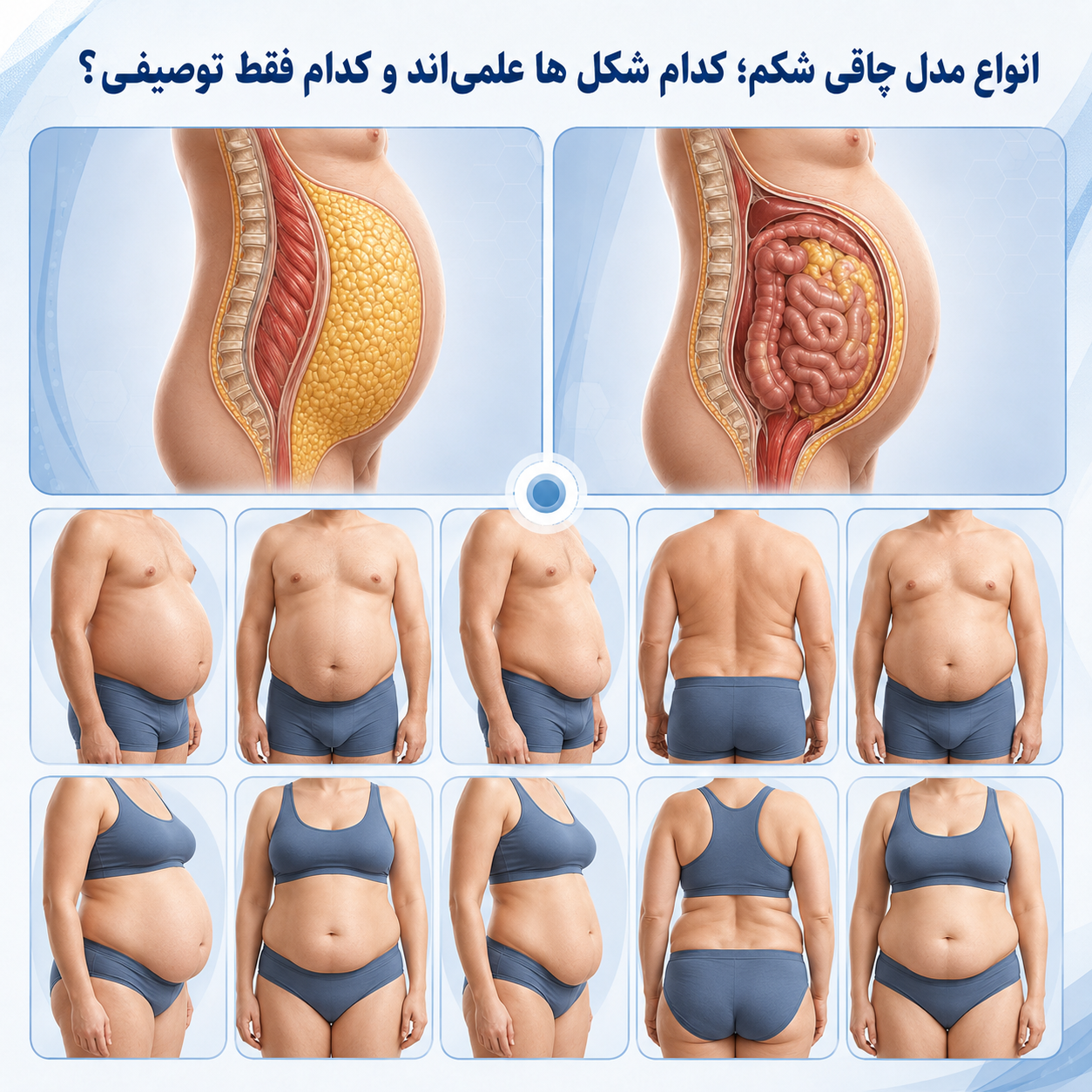انواع چاقی شکم از نظر پزشکی | علائم، علت و ارزیابی 9 انواع چاقی شکم؛ کدام شکلها علمیاند و کدام فقط توصیفی؟